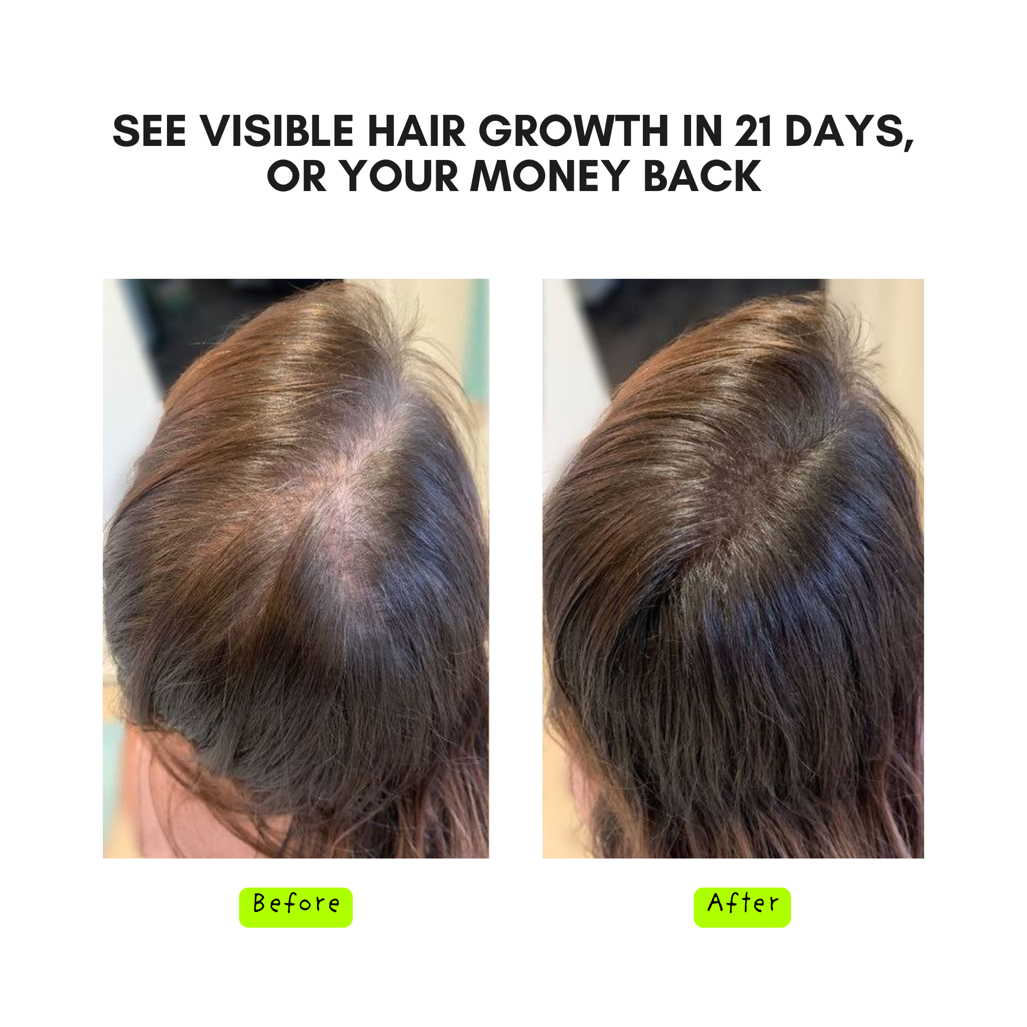 14-Herb & Oil blend for Rapid Hair Growth – 150ML
