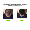 14-Herb & Oil blend for Rapid Hair Growth – 150ML